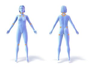fibromylagia-pain-point-picture