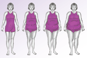 Hormone imbalance