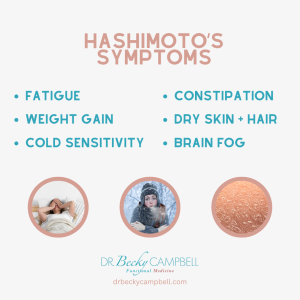 Hashimoto’s Thyroiditis