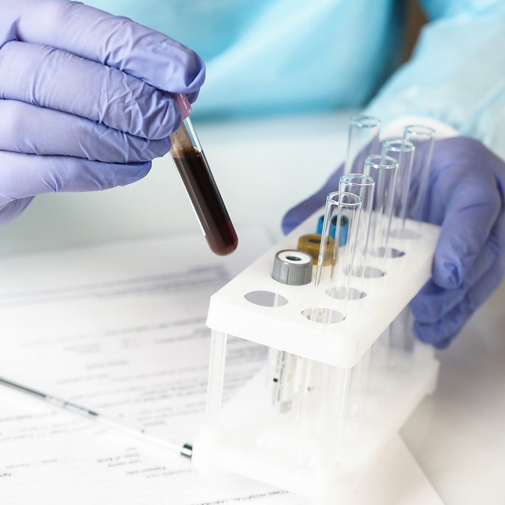 medical test